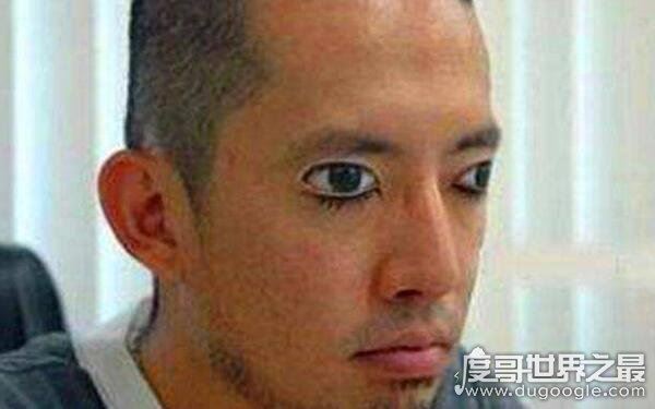 全球十大恐怖怪病,让人心生恐惧(怪病)
