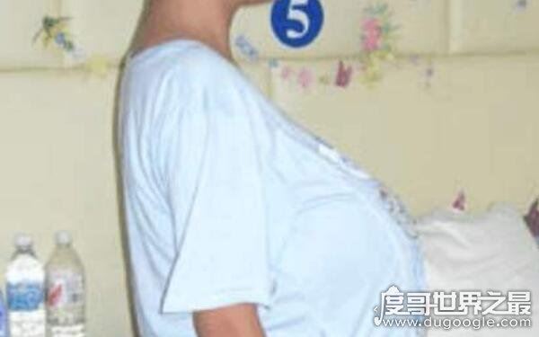 全球十大恐怖怪病，让人心生恐惧（怪病）