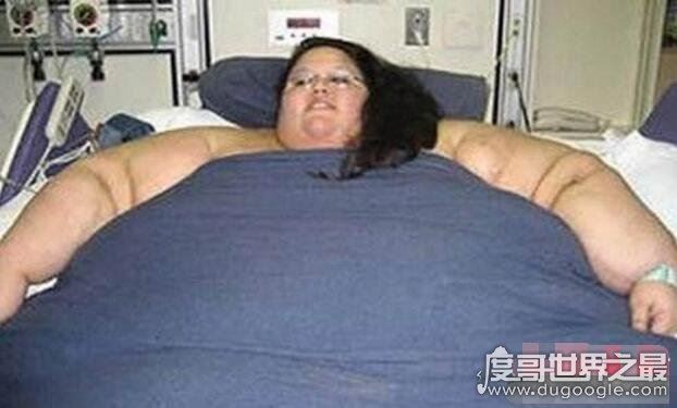 世界上最胖的女人,苏珊娜·埃曼1450斤(超胖女人大合集)