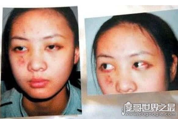 张默打童瑶真相曝光，遭潜规则1年多后被张默发现