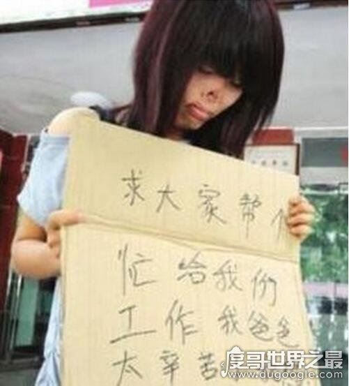 无鼻女也有春天,整容后走进婚姻的殿堂(别看老照片)