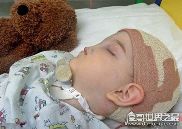 无鼻女也有春天，整容后走进婚姻的殿堂(别看老照片)