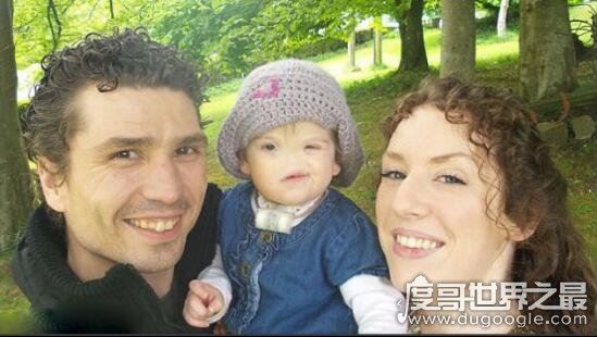 无鼻女也有春天，整容后走进婚姻的殿堂(别看老照片)