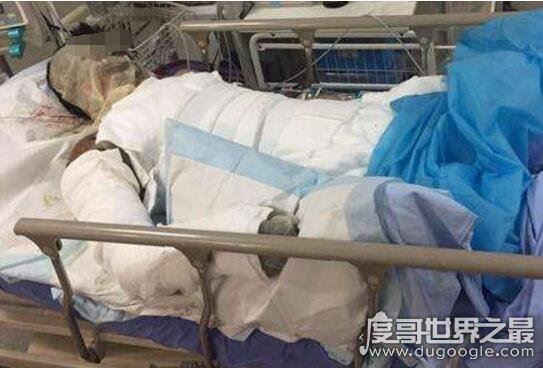 偷钓鱼触碰高压线被电,鱼竿导电性强触碰后会被"电击"