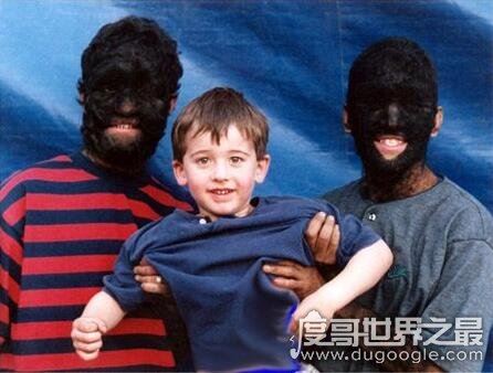 世界上毛最多的人盘点，整个身体99%的部位被毛覆盖(组图)