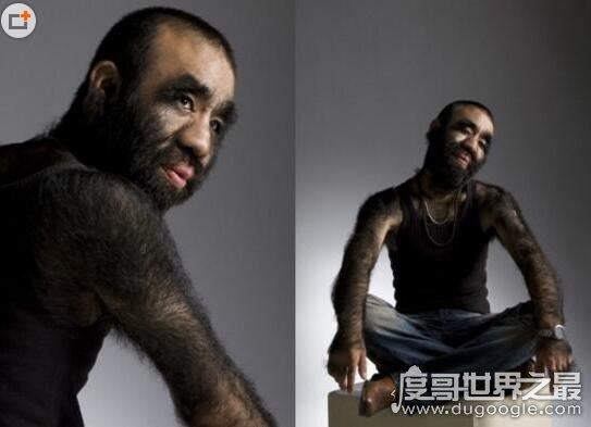 世界上毛最多的人盘点，整个身体99%的部位被毛覆盖(组图)