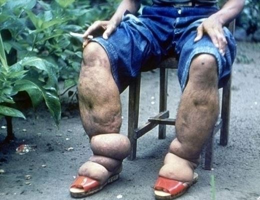 十大令人羡慕的怪病，得了第一种病能让人暴富