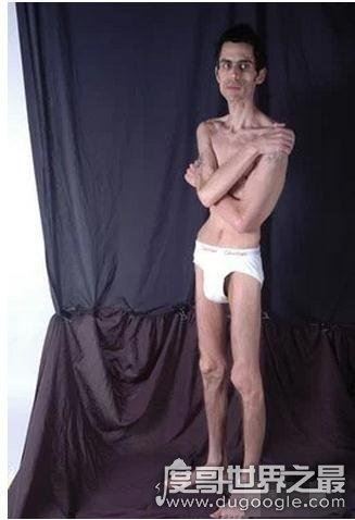 世界上超级瘦的人图片，最瘦的女人40斤/最瘦的男人80斤