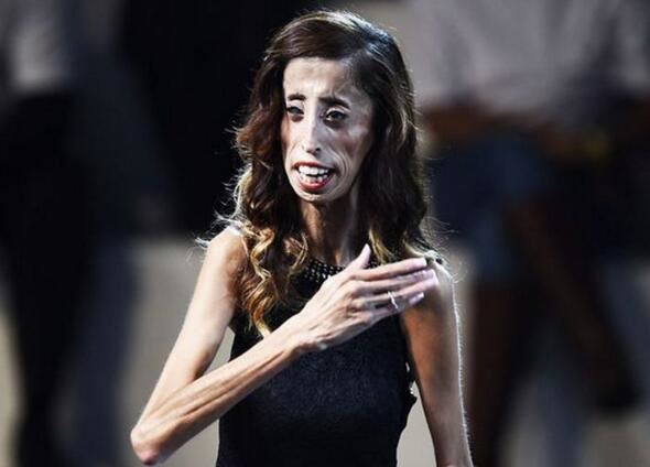 世界上超级瘦的人图片，最瘦的女人40斤/最瘦的男人80斤