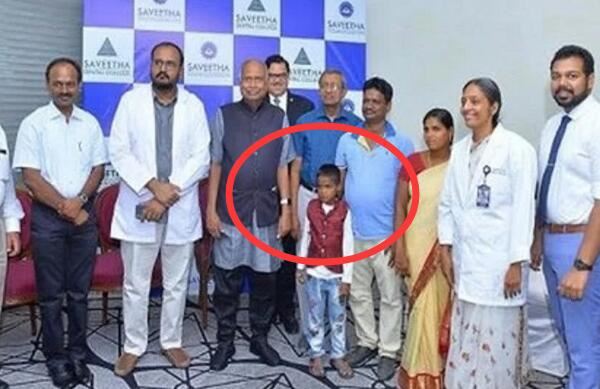 世界上牙齿最多的人，拉文德拉纳特一次拔出大小不一526颗牙齿