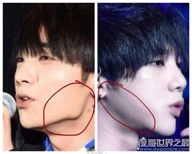 华晨宇整容前后照片对比，鼻翼和下颌骨动刀最明显