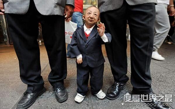 世界上最小的人,袖珍人马加尔高50厘米重4.5公斤