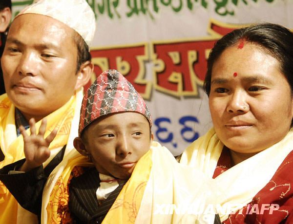 世界上最小的人，袖珍人马加尔高50厘米重4.5公斤