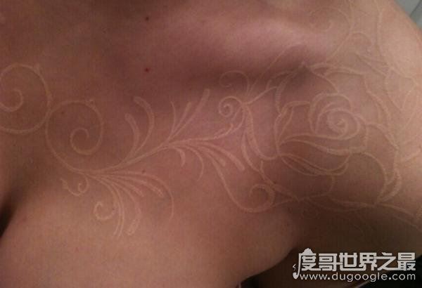 鸽子血纹身被称为隐形纹身,在饮酒或情绪激动时会变成红色