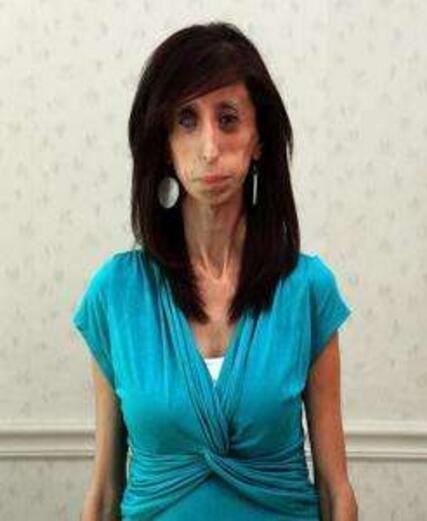 美国零脂肪女孩，丽兹·维拉斯奎兹(体重仅仅只有54斤)