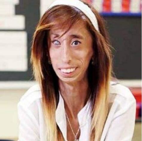 美国零脂肪女孩，丽兹·维拉斯奎兹(体重仅仅只有54斤)