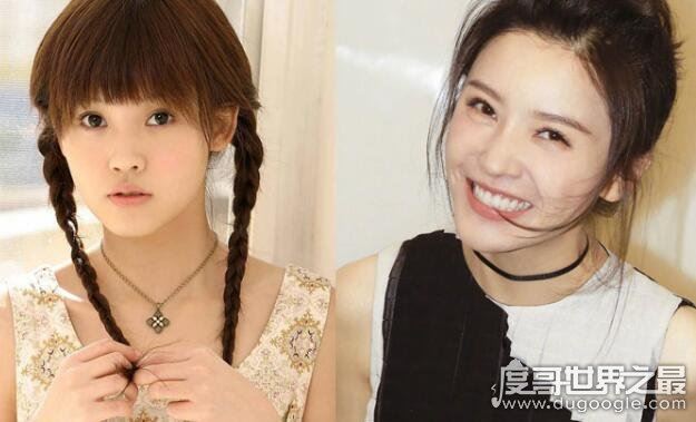 杨子珊整容前后照片对比,很明显卧蚕都整没了