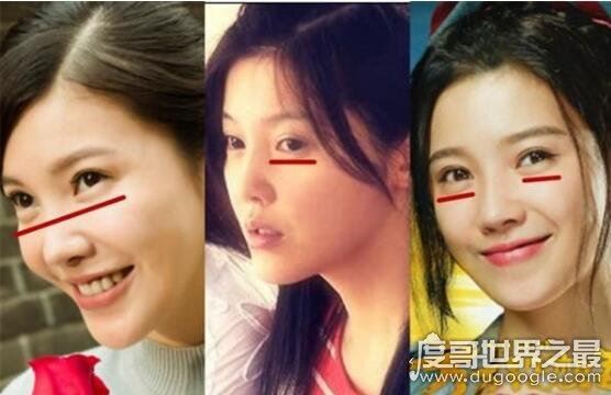 杨子珊整容前后照片对比，很明显卧蚕都整没了