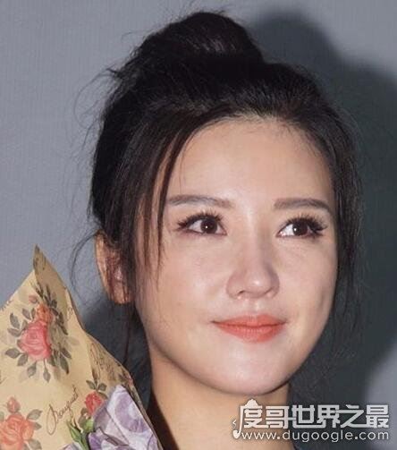 杨子珊整容前后照片对比，很明显卧蚕都整没了