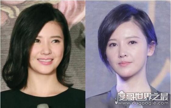 杨子珊整容前后照片对比,很明显卧蚕都整没了
