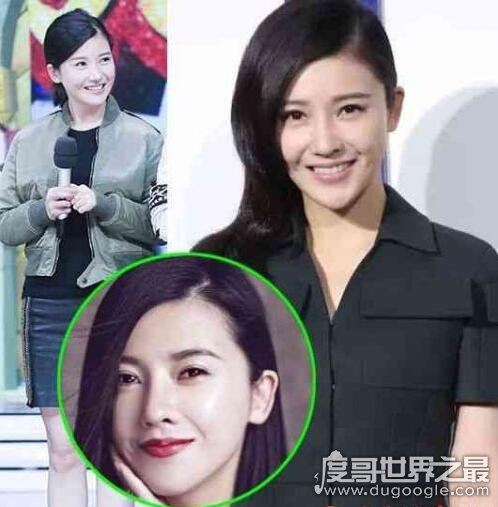 杨子珊整容前后照片对比，很明显卧蚕都整没了