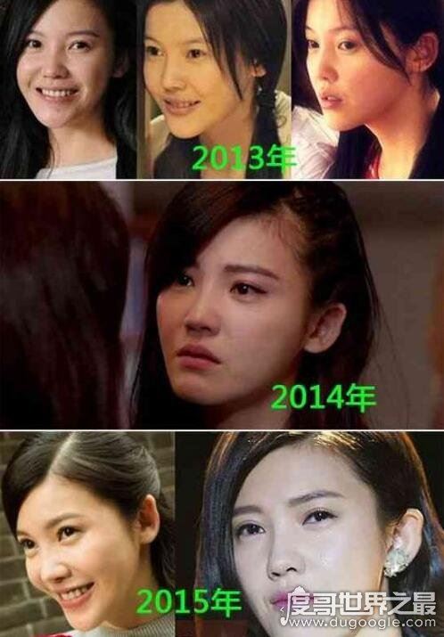 杨子珊整容前后照片对比，很明显卧蚕都整没了
