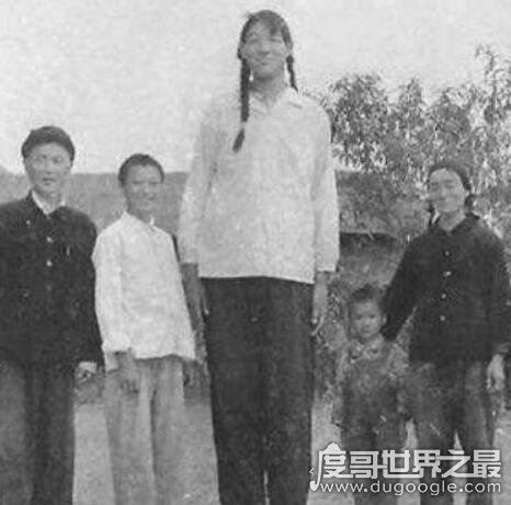 全球史上最高的女性,中国曾金莲2.48米(身患巨人症)