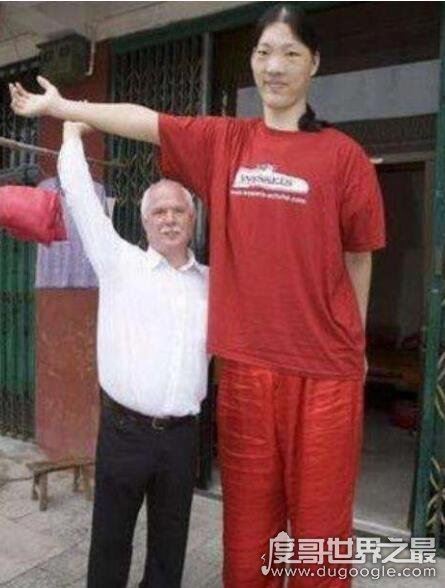 全球史上最高的女性，中国曾金莲2.48米(身患巨人症)