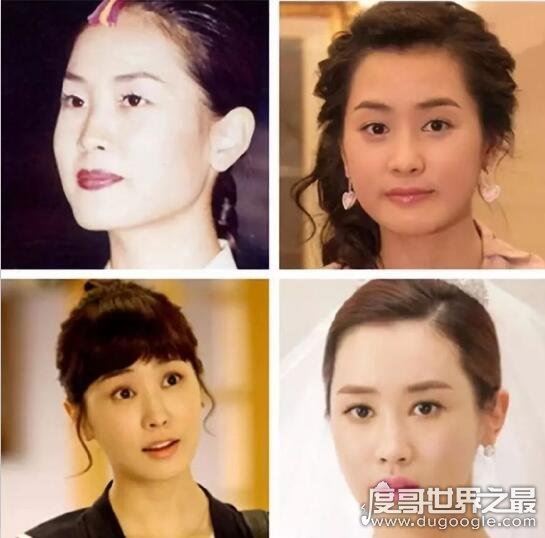 李多海被质疑整容，彻底换脸颠覆原来容貌(公司称角度问题)