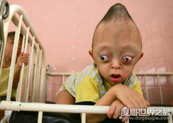 福岛核泄漏后变异女人，生出巨型“幽灵婴儿”(头皮发麻)