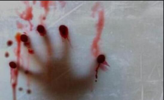 肢体雪人的悬疑案件，真人真头堆做的雪人（胆小勿入）