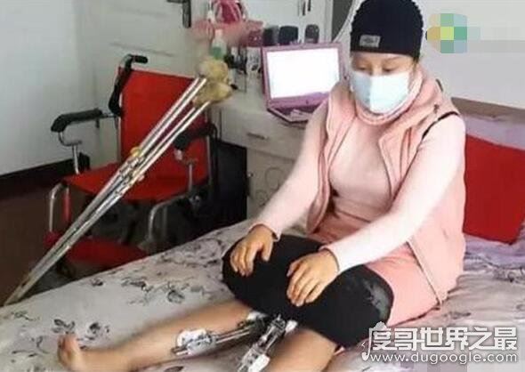 中国第一整容狂人,花费400万元整容200多次(将自己身体整垮)