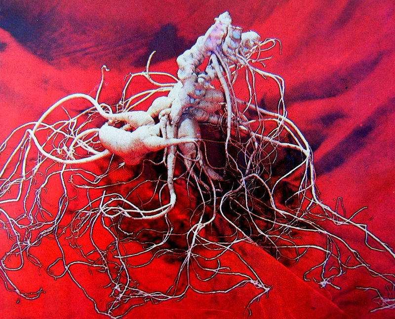 世界上最老的人参，看一眼都感觉神清气爽（延年益寿）