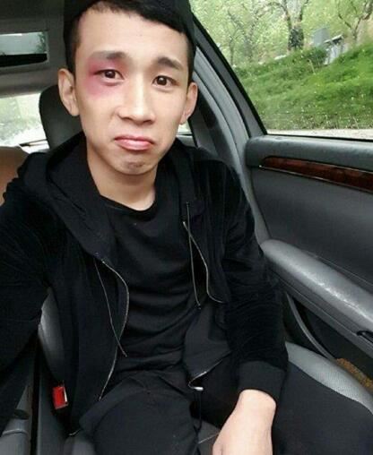 mc天佑被打照片幕后真相,头破血流现场血腥暴力