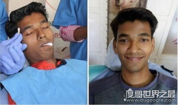 世界上牙齿最多的动物，蜗牛(牙齿全在舌头上共有26000多颗)