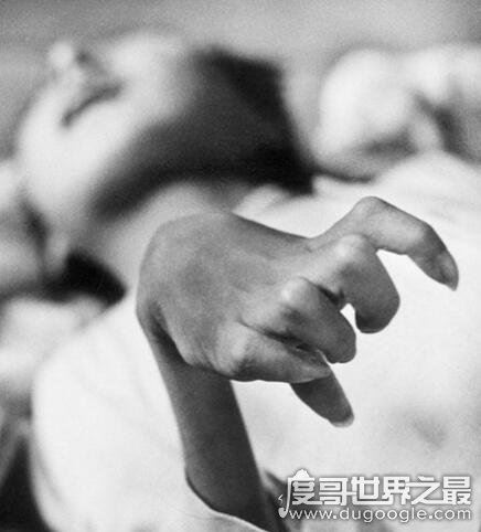 震惊世界的日本水俣病事件，是最早出现的公害病