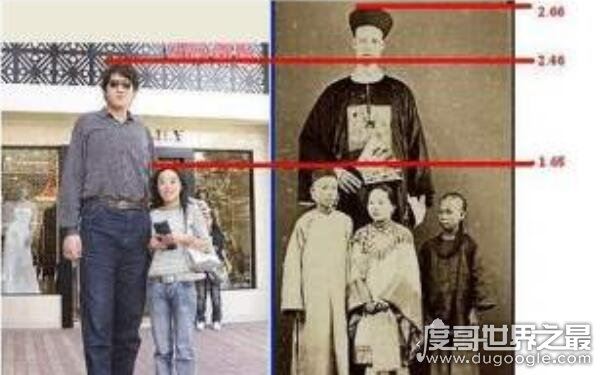 世界上最高的人前十名,身高3.19米(詹世钗)
