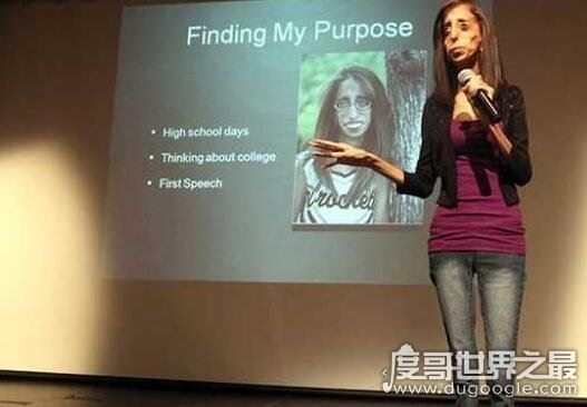 世界上最丑的人丽兹·维拉斯奎兹，被人们称之为骷髅女孩