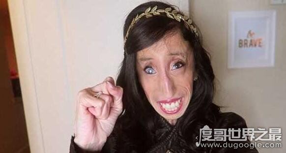 世界上最丑的人丽兹·维拉斯奎兹，被人们称之为骷髅女孩