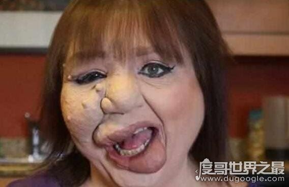 世界上最丑的人丽兹·维拉斯奎兹，被人们称之为骷髅女孩