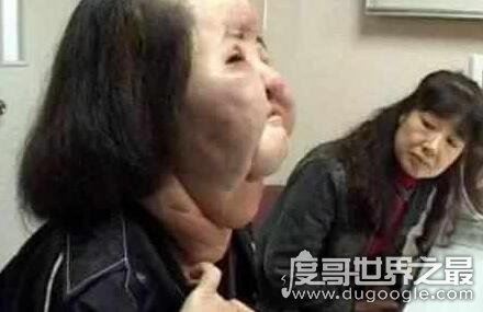 世界上最丑的人丽兹·维拉斯奎兹,被人们称之为骷髅女孩