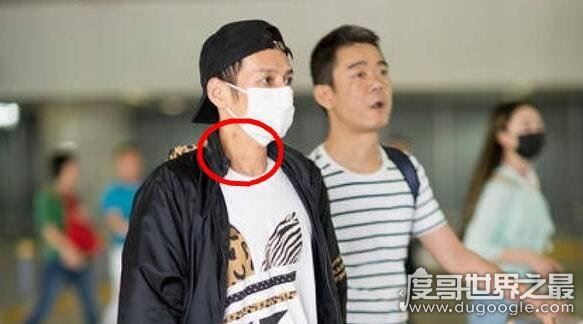 李维嘉得艾滋被证实是扯淡，脖子红点只是夏季正常的红疹