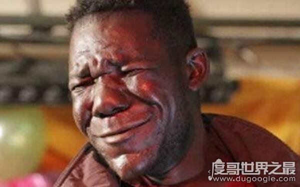 最丑的男人马斯韦努,四次蝉联最丑比赛冠军(外貌丑陋无比)