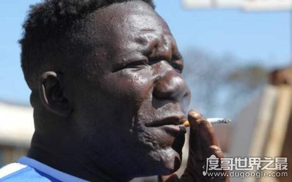 最丑的男人马斯韦努，四次蝉联最丑比赛冠军(外貌丑陋无比)