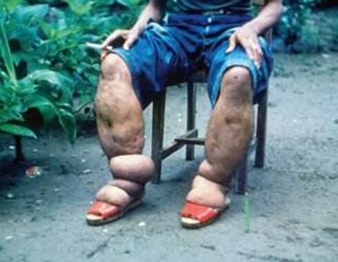 世界10大最恶心的寄生虫，龙线虫最恶心(一条长几十厘米)