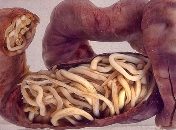 世界10大最恶心的寄生虫，龙线虫最恶心(一条长几十厘米)