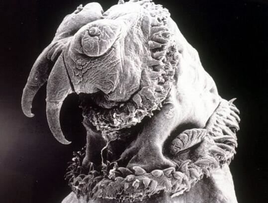 世界10大最恶心的寄生虫，龙线虫最恶心(一条长几十厘米)