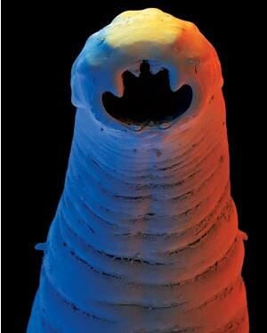 世界10大最恶心的寄生虫，龙线虫最恶心(一条长几十厘米)