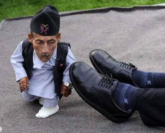 世界上最小的脚,也是世界上最矮的人(高54.6/脚长5厘米)