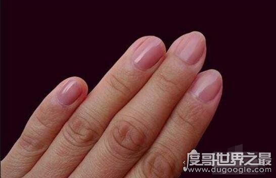 一般来说健康的手指甲是什么样子的，平整光滑呈粉红色(6.4蚂蚁庄园答案)